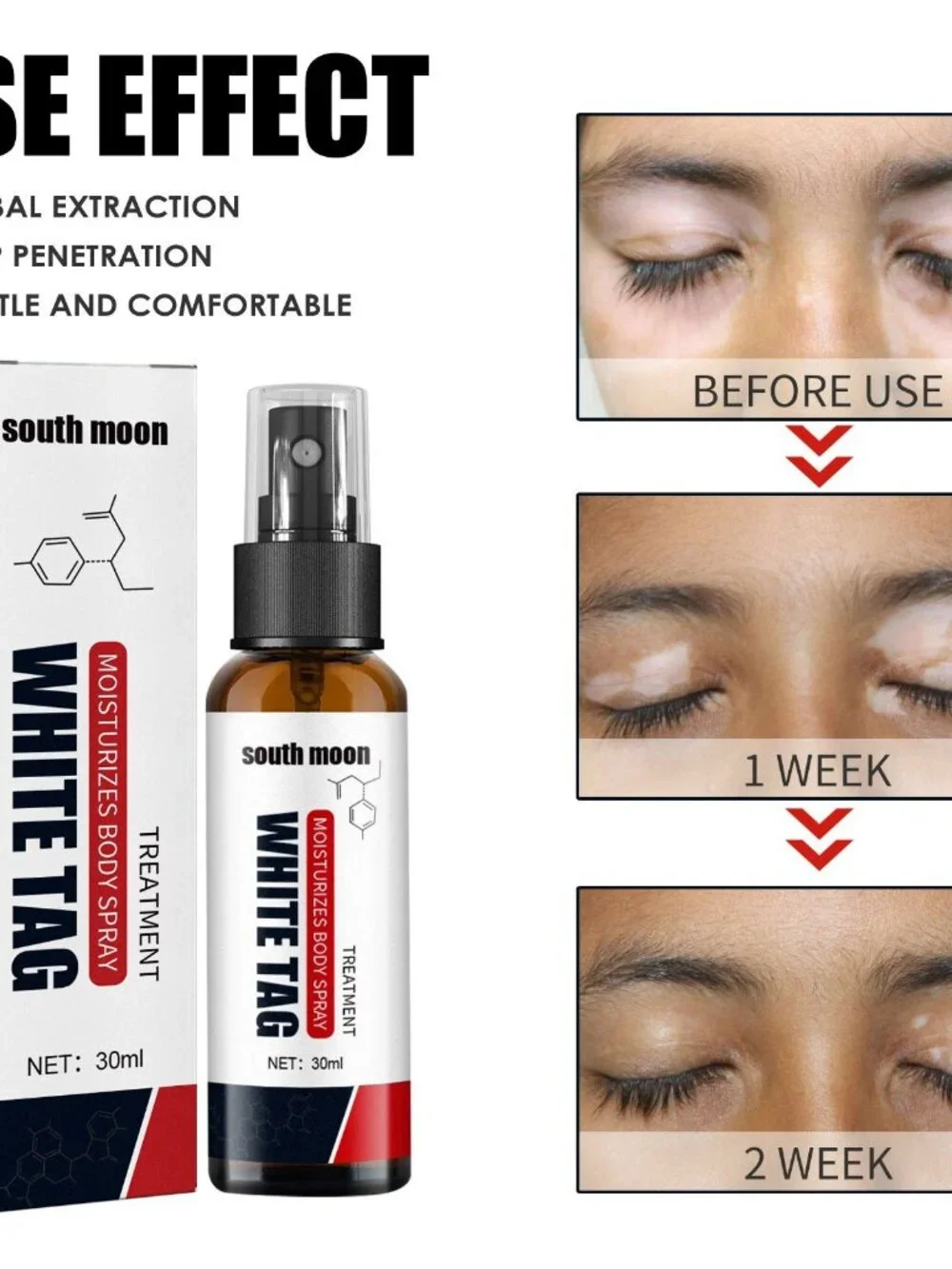 White Net Spray Repair Flower Spot Liquid For External Skin Care - 30ml